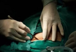 刨腹产视频,直观呈现母婴安全守护